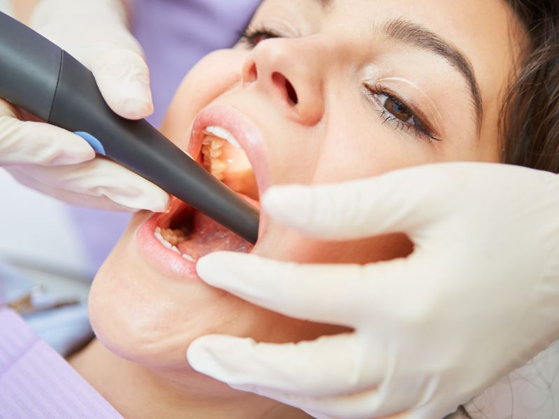 Kök Ucu Açık/Kapalı Dişlerde Kanal Tedavisi/Rejeneratif Tedavi